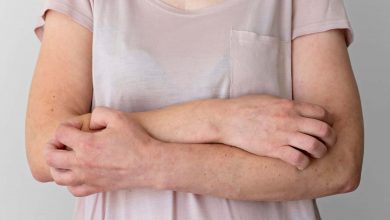Esistono diversi modo per combattere la dermatite seborroica ma spesso sarà necessario rivolgersi al medico di fiducia