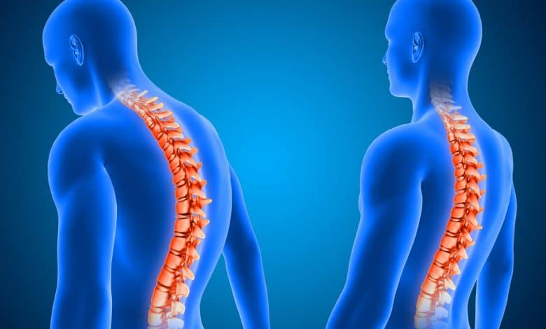 Molte persone soffrono di disturbi alla schiena a causa della postura scorretta: questo può causare rischi e conseguenze per la salute
