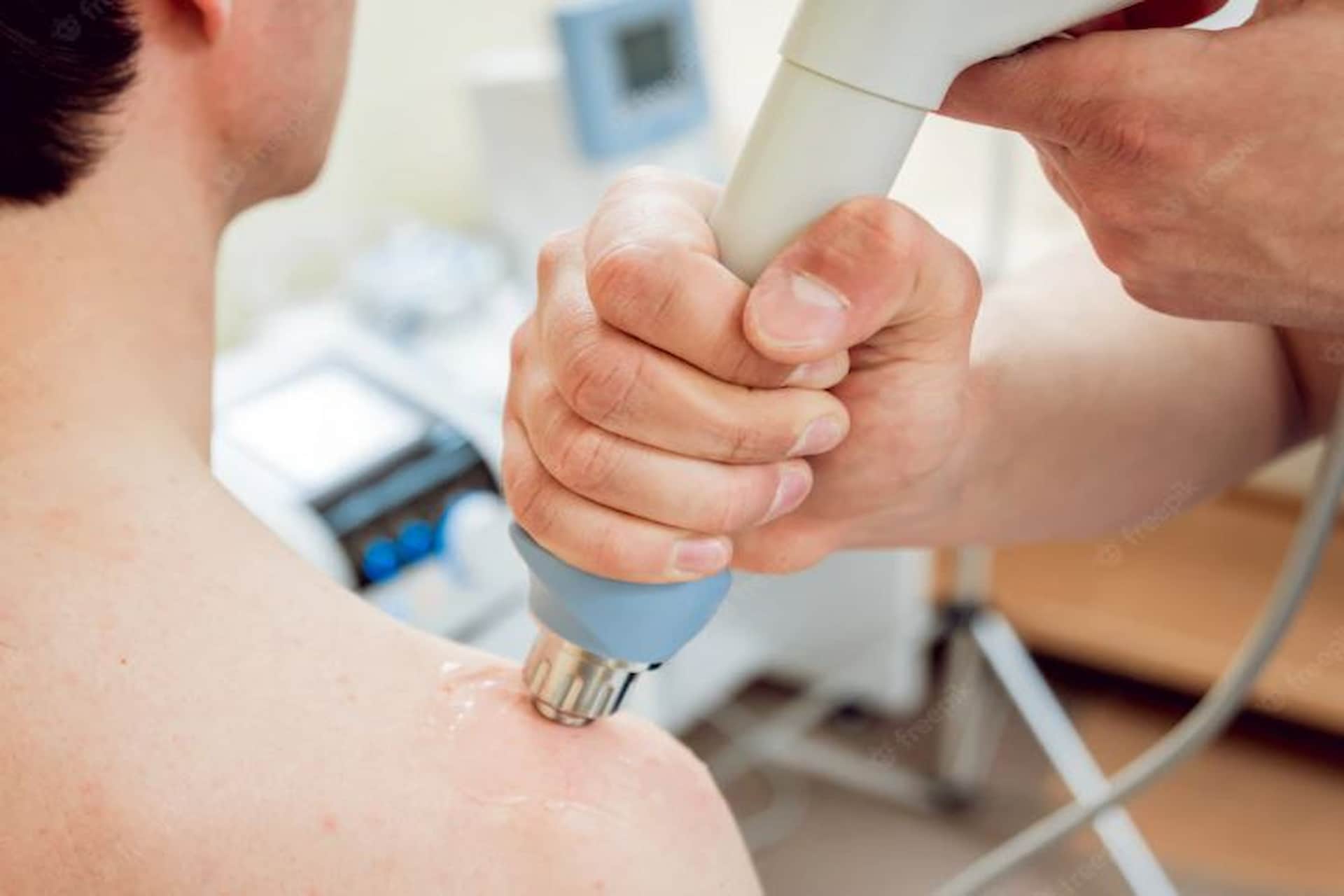 La terapia con onde d'urto è un metodo non invasivo ampiamente utilizzato per i suoi effetti veramente efficaci